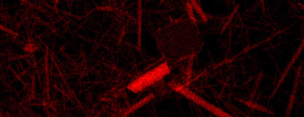 Electorn Microscope Image La2CuO4 nanostructures